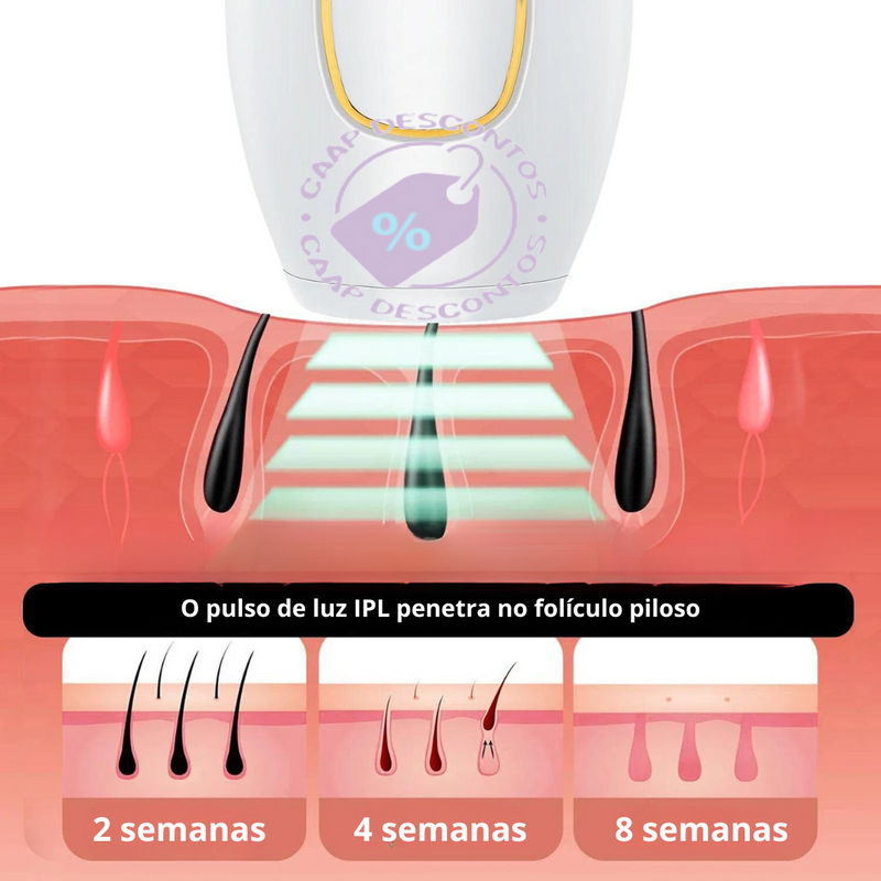 Laser Glow Pro: Depilador Permanente + Brinde